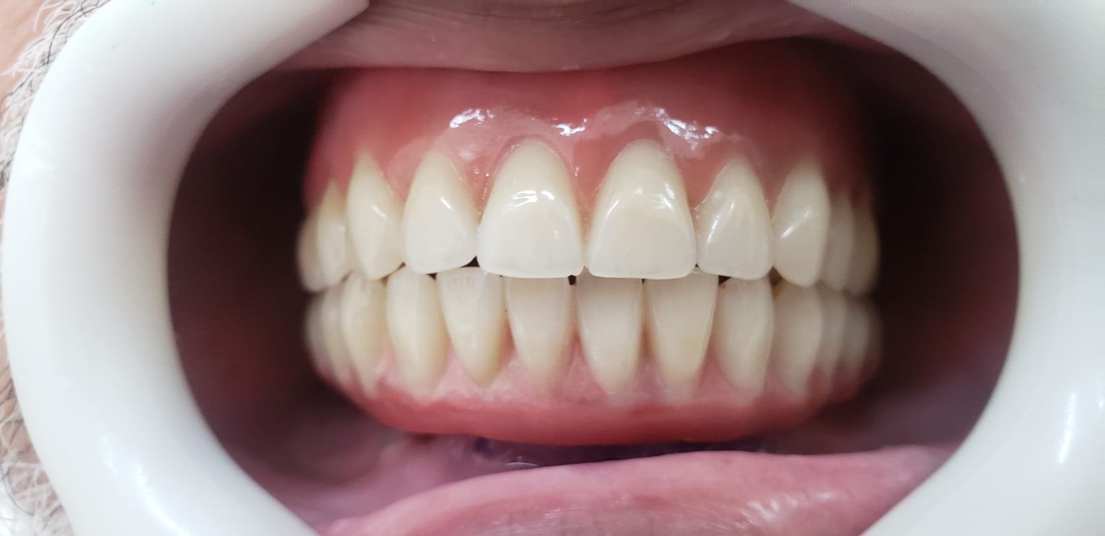 WhatsApp Image 2022-05-17 at 11.33.23 (1)